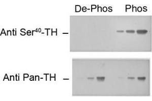 Image no. 1 for anti-Tyrosine Hydroxylase (TH) (pSer40) antibody (ABIN372738) (Tyrosine Hydroxylase antibody  (pSer40))