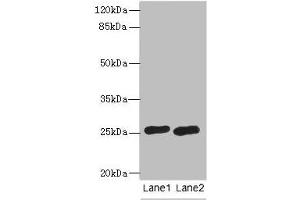 Western blot All lanes: RAB20 antibody at 0. (RAB2A antibody  (AA 1-234))