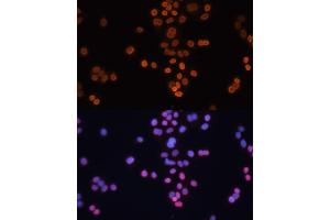Immunofluorescence analysis of HT-29 cells using CDX2 antibody (ABIN3022281, ABIN3022282, ABIN3022283 and ABIN6218711) at dilution of 1:100. (CDX2 antibody  (AA 1-180))