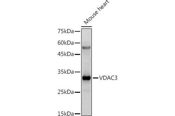 VDAC3 antibody  (AA 1-283)