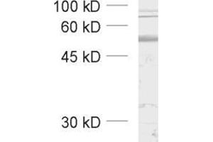 dilution: 1 : 1000, sample: unboiled synaptic membrane fraction of rat brain (LP1) (GABRB3 antibody  (AA 344-429))