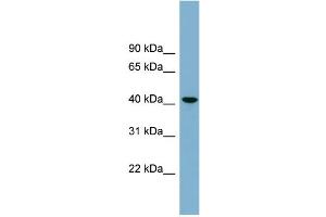 WB Suggested Anti-B4GALT2  Antibody Titration: 0. (B4GALT2 antibody  (Middle Region))