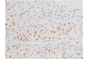 Immunohistochemistry (IHC) image for anti-Nuclear Factor-kB p65 (NFkBP65) (pSer281) antibody (ABIN6255162)