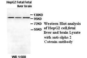 Image no. 1 for anti-Catenin (Cadherin-Associated Protein), alpha 2 (CTNNA2) antibody (ABIN6583527) (CTNNA2 antibody)