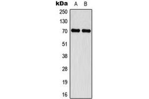 Western blot analysis of Merlin (pS518) expression in MCF7 IFN-treated (A), Jurkat IFN-treated (B) whole cell lysates. (Merlin antibody  (C-Term, pSer518))
