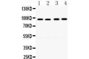 Western Blotting (WB) image for anti-CD19 Molecule (CD19) (AA 307-337), (Middle Region) antibody (ABIN3043389) (CD19 antibody  (Middle Region))