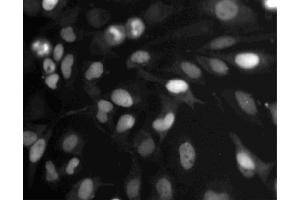 Immunofluorescent staining of HeLa cells. (Topo IIalpha (AA 1245-1361) antibody)