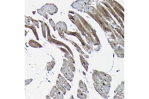 Immunohistochemistry of paraffin-embedded rat heart using Nesprin 1 Rabbit pAb (ABIN7270520) at dilution of 1:100 (40x lens). (SYNE1 antibody)