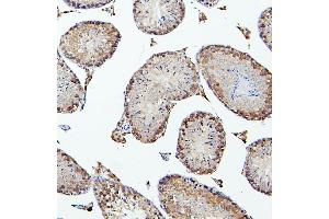 IHC analysis of PEF1 using anti-PEF1 antibody (ABIN6719632). (PEF1 antibody  (AA 170-284))