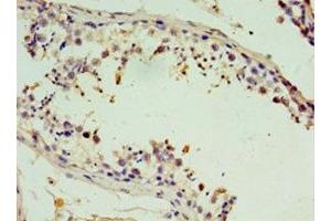 Immunohistochemistry of paraffin-embedded human testis tissue using ABIN7171225 at dilution of 1:100
