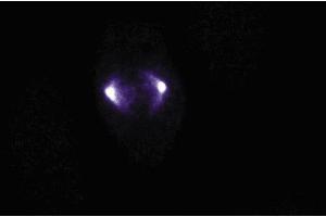 Immunofluorescence staining of human endothelial cells. (Aurora A antibody  (AA 8-116))