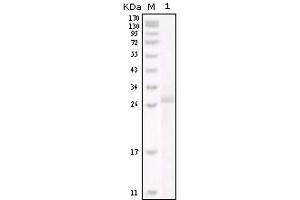 Western blot analysis using HER-2 mouse mAb against truncated HER-2 recombinant protein. (ErbB2/Her2 antibody)
