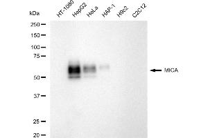 Western blotting analysis using MICA antibody (ABIN7799403).