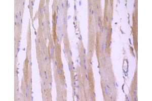 Immunohistochemistry of paraffin-embedded mouse heart using ROCK1 antibody (ABIN4905028) at dilution of 1:100 (40x lens). (ROCK1 antibody)