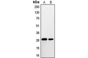 Western blot analysis of PSCA expression in DU145 (A), human prostate (B) whole cell lysates. (PSCA antibody  (Center))