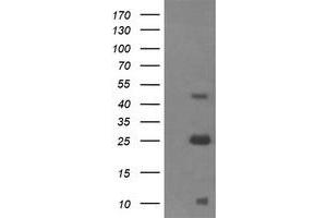 Western Blotting (WB) image for anti-Aldehyde Dehydrogenase 1 Family, Member A3 (ALDH1A3) (AA 1-100), (AA 413-512) antibody (ABIN1490538) (ALDH1A3 antibody  (AA 1-100, AA 413-512))