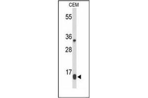 Western blot analysis of DIRAS1 Antibody in CEM cell line lysates (35ug/lane). (DIRAS1 antibody  (Middle Region))
