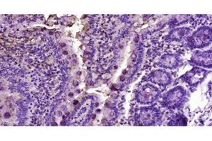 Paraformaldehyde-fixed, paraffin embedded Rat small intestine, Antigen retrieval by boiling in sodium citrate buffer (pH6. (Progestin Receptor beta/mprb (AA 251-300) antibody)