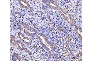 IHC analysis of RPL29 using anti-RPL29 antibody (ABIN7600993). (RPL29 antibody  (AA 27-153))