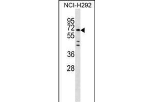 MIER3 Antibody (Center) (ABIN1538243 and ABIN2849902) western blot analysis in NCI- cell line lysates (35 μg/lane). (MIER3 antibody  (AA 284-312))