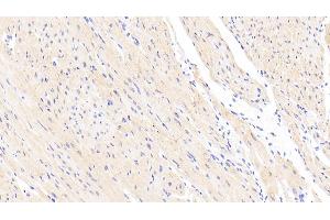 Detection of CNN2 in Human Cardiac Muscle Tissue using Polyclonal Antibody to Calponin 2 (CNN2) (CNN2 antibody  (AA 1-269))