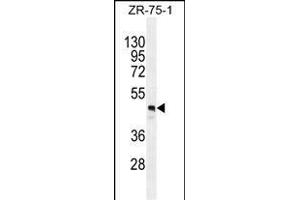 FUT4 Antibody (Center) (ABIN389262 and ABIN2839399) western blot analysis in ZR-75-1 cell line lysates (35 μg/lane). (CD15 antibody  (AA 242-271))