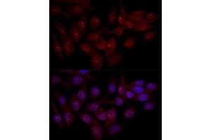 Immunofluorescence (IF) image for anti-Eukaryotic Translation Initiation Factor 6 (EIF6) (AA 1-245) antibody (ABIN3022603)