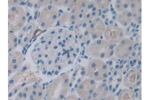 DAB staining on IHC-P; Samples: Rat Kidney Tissue (ROS1 antibody  (AA 1937-2210))