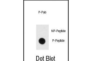 Dot blot analysis of anti-Phospho-MBP- Antibody (ABIN389939 and ABIN2839752) on nitrocellulose membrane.