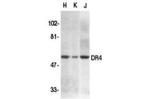 Western blot analysis of DR4 in HeLa (H), K562 (K), and Jurkat (J) whole cell lysate with AP30300PU-N DR4 antibody at 1/500 dilution.