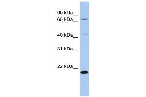 AMD1 antibody used at 1 ug/ml to detect target protein. (AMD1 antibody  (N-Term))