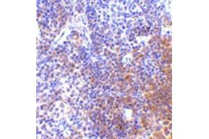 Image no. 2 for anti-Interferon Regulatory Factor 7 (IRF7) (C-Term) antibody (ABIN318754) (IRF7 antibody  (C-Term))