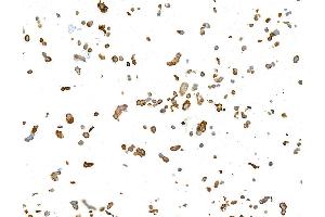 Immunocytochemistry (ICC) image for anti-Keratin 19 (KRT19) antibody (ABIN7449419) (Cytokeratin 19 antibody)