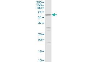 MKKS MaxPab rabbit polyclonal antibody. (MKKS antibody  (AA 1-570))