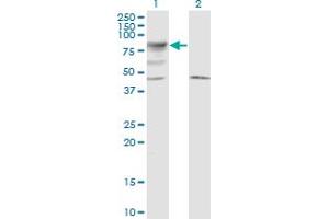 Western Blot analysis of LRRN2 expression in transfected 293T cell line by LRRN5 monoclonal antibody (M01), clone 6A9. (LRRN2 antibody  (AA 532-630))