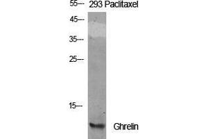 Western Blot (WB) analysis of specific cells using Ghrelin Polyclonal Antibody. (Ghrelin antibody  (Internal Region))