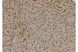 ABIN6275831 at 1/100 staining Rat liver tissue by IHC-P.