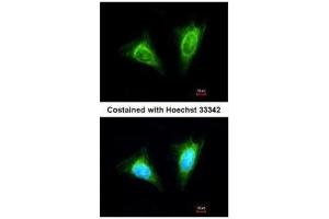 ICC/IF Image Immunofluorescence analysis of methanol-fixed HeLa, using KLRC1, antibody at 1:200 dilution. (KLRC1 antibody  (N-Term))
