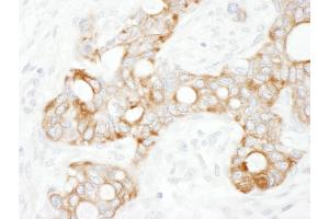 Immunohistochemistry (IHC) image for anti-TNF Receptor-Associated Factor 2 (TRAF2) (AA 300-350) antibody (ABIN7453559)