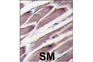 Formalin-fixed and paraffin-embedded human skeletal muscle tissue reacted with LATS2 antibody (Center), which was peroxidase-conjugated to the secondary antibody, followed by DAB staining.