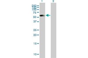 Western Blot analysis of ATP5B expression in transfected 293T cell line by ATP5B MaxPab polyclonal antibody. (ATP5B antibody  (AA 1-529))