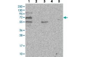 Western blot analysis of Lane 1: RT-4, Lane 2: U-251 MG, Lane 3: Human Plasma, Lane 4: Liver, Lane 5: Tonsil with SOWAHB polyclonal antibody .