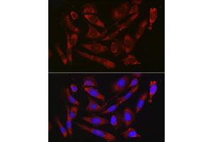 Immunofluorescence analysis of U2OS cells using CD47 Rabbit pAb (ABIN3022623, ABIN3022624, ABIN3022625, ABIN1512716 and ABIN6218964) at dilution of 1:50 (40x lens). (CD47 antibody  (AA 20-140))
