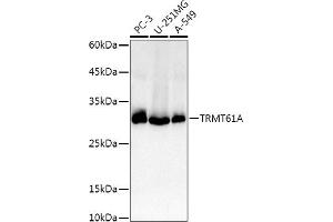 Western blot analysis of extracts of various cell lines, using TRMT61A antibody (ABIN6132806, ABIN6149558, ABIN6149559 and ABIN6214904) at 1:1000 dilution. (TRMT61A antibody  (AA 1-289))