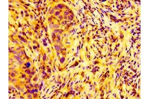 Immunohistochemistry (IHC) image for anti-ADP-Ribosylation Factor Guanine Nucleotide-Exchange Factor 2 (Brefeldin A-Inhibited) (ARFGEF2) (AA 200-317) antibody (ABIN7145776)