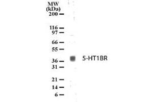 Image no. 1 for anti-Serotonin Receptor 1B (HTR1B) (AA 8-26) antibody (ABIN208265) (5HT1B Receptor antibody  (AA 8-26))