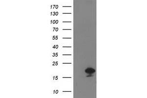 HEK293T cells were transfected with the pCMV6-ENTRY control (Left lane) or pCMV6-ENTRY DSTN (Right lane) cDNA for 48 hrs and lysed. (Destrin antibody)