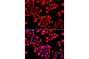 Immunofluorescence analysis of A549 cells using XRCC6 antibody. (XRCC6 antibody  (AA 408-609))