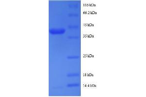 SDS-PAGE (SDS) image for Ribosomal Protein S19 Binding Protein 1 (RPS19BP1) (AA 1-145), (full length) protein (GST tag) (ABIN7479589)