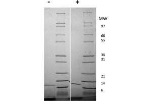 SDS-PAGE of Mouse Interleukin-13 Recombinant Protein SDS-PAGE of Mouse Interleukin-13 Recombinant Protein.